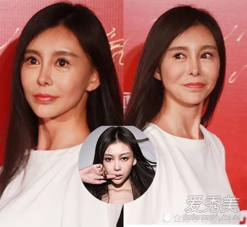 深度剖析明星整容失败案例与观点阐述