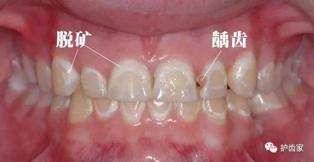 美国再生牙齿技术革新掀起牙科技术革命风潮的最新消息