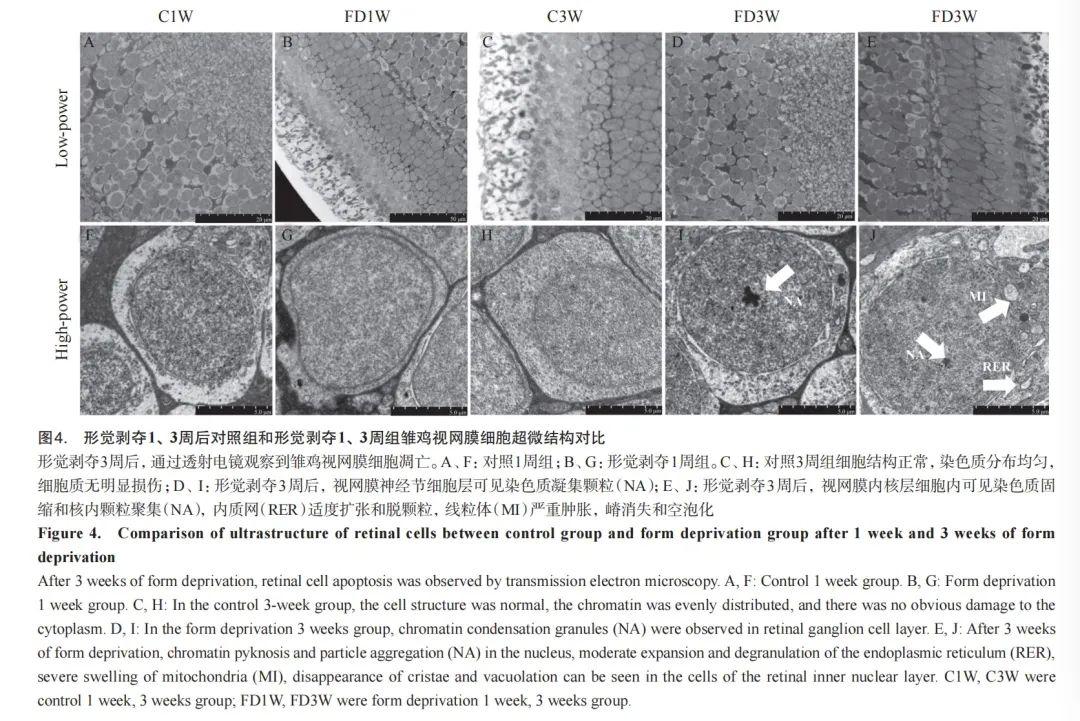 近视治疗最新研究进展与观点论述摘要